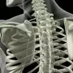 Osteoporose: Symptome, Therapie, Behandlung, Ernährung, Ursachen und Medikamente