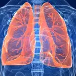 Lungenemphysem (COPD): Definition, Lebenserwartung, Symptome, Therapie, Ursachen und Behandlung