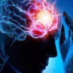 Schlaganfall: Symptome, Anzeichen, Ursachen, Folgen, Test, Therapie und Behandlung