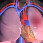 Lungenembolie: Symptome, Anzeichen, Ursachen, Therapie, Behandlung und Folgen