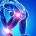 Morbus Sudeck: Hand, Fuß, Symptome und Behandlung