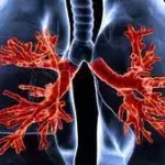 Mukoviszidose: Symptome, Lebenserwartung, Ursachen, Vererbung und Therapie