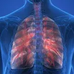 Lungenentzündung: Symptome und Anzeichen, Dauer und Behandlung