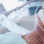 Patient mit Beatmungsgerät