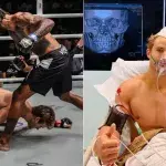 Sage Northcutt nach seiner spektakulären Ko-Niederlage gegen den Brasilianer Cosmo Alexandre