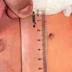 Das Baby wurde im Mutterleib angeschossen.