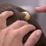 Riesige Beule am Kopf