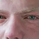 Aus diesem erstaunlichen Grund röten sich unsere Augen nach dem Weinen