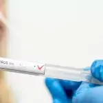 PCR-Test