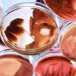 Staphylokokken: Ansteckung, Symptome und Behandlung