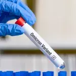 Südafrikanische Forscher glauben, Omikron könnte Delta eindämmen