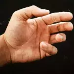 Zukunft und Gesundheit: Das verraten die Linien an deinem Handgelenk