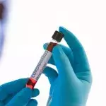 Covid-19: Diese Studie zu infizierten Pflegekräften verrät uns mehr über die Immunität