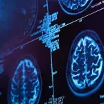 Forschung: Geräusche und Licht wirken sich positiv auf Alzheimer-Patienten aus