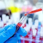HIV-Patient geheilt 