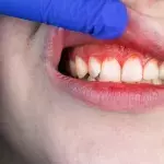 Krankheit aus dem 18. Jahrhundert