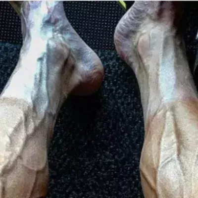 Tour de France: Radprofi schockiert mit Horror-Beinen