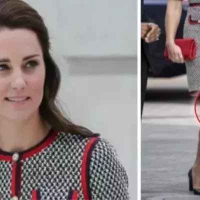 Kate Middleton: Geistergesicht auf ihrem Knie?