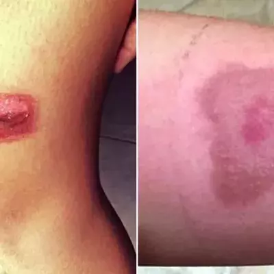 Die „Salt and Ice Challenge“: Die neueste Verrücktheit der sozialen Netzwerke könnte dich teuer zu stehen kommen