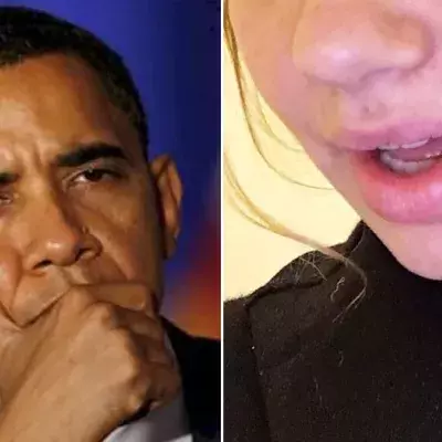 Der Hund der Familie Obama sorgt für Ärger