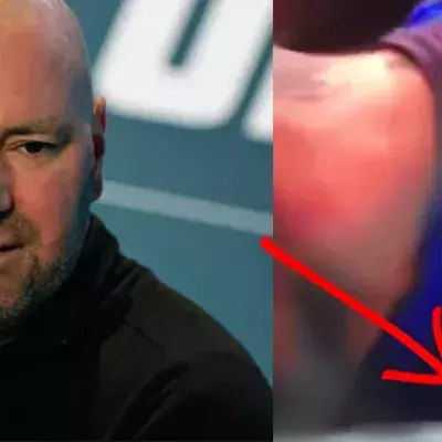 Niko Price verliert geheimnisvolle Pille mitten im Fight