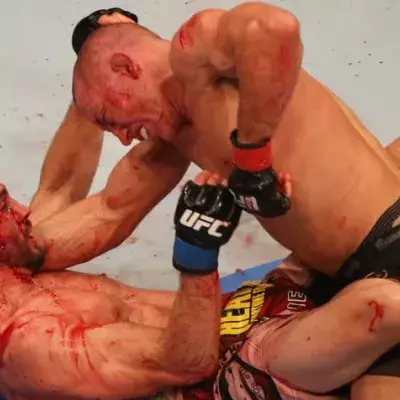 Georges St. Pierre vs. Carlos Condit: Der härteste Kampf der gesamten Karriere von GSP