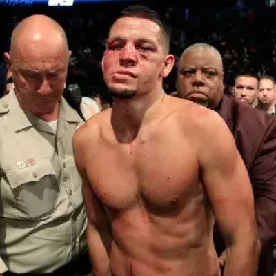 UFC: Wie Nate Diaz seine Karriere zerstört!