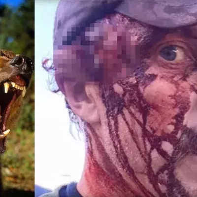 Ein Mann filmt sich blutüberströmt nach einem Grizzly-Angriff