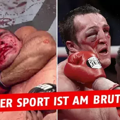 Warum Boxen gefährlicher ist als die MMA?