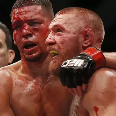 Conor McGregor vs. Nate Diaz II: Der großartige Respekt zwischen den beiden Kämpfern