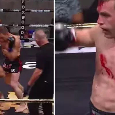 Muay Thai: Gaston Bolanos verpasst seinem Gegner einen mörderischen Ellenbogenschlag in den Kopf