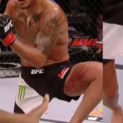 UFC 197: Edson Barbosa wird von Anthony Pettis stark verletzt