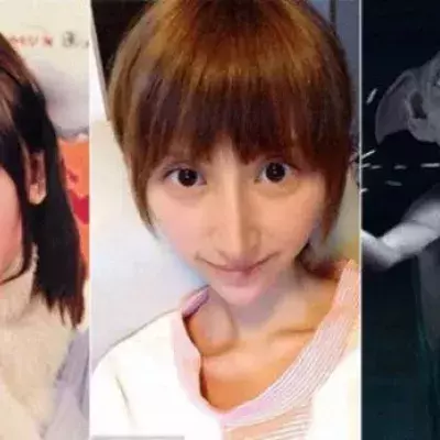Japan: Ein XXX-Star macht eine Schönheitsoperation, um wie Dobby, der Elf aus Harry Potter, auszusehen