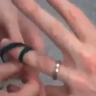 Wie entfernt man einen zu engen Ring mit einem Gummiband? Hier ist die unfehlbare Technik