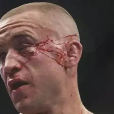 MMA: Die schlimmsten Verletzungen, die je im Oktagon gesehen wurden