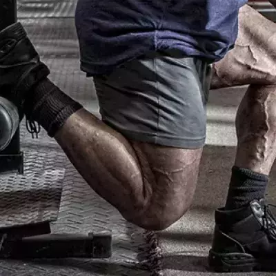 Krafttraining für die Beine: Die besten Übungen für eure Oberschenkel