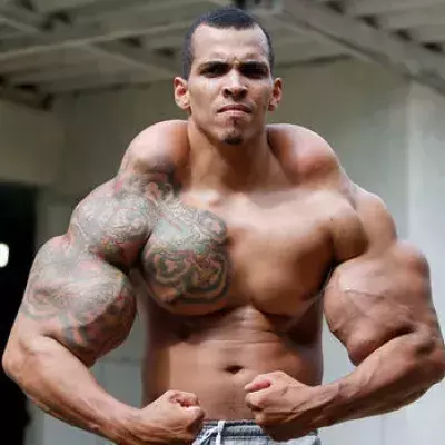 Romario Dos Santos Alves, der Bodybuilder, der wie Hulk aussehen wollte