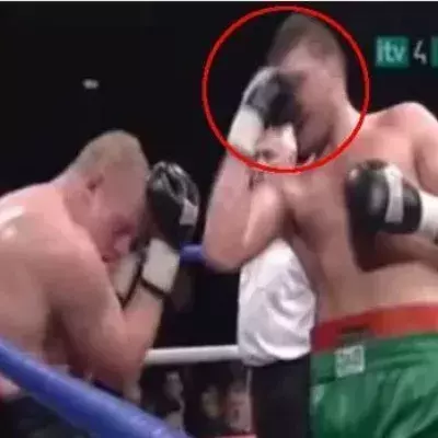 Tyson Fury schlägt sich mitten im Kampf einfach selbst