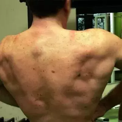 Wegen Kokain und Anabolika: Zwei junge Fitnessfans verhaftet