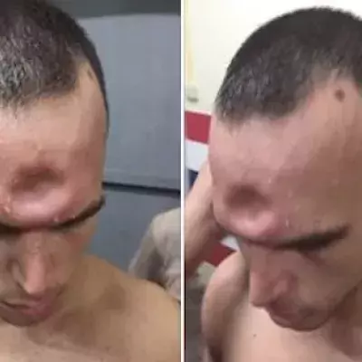 Muay-Thai-Kämpfer bekommt Ellenbogenschlag ab. Erst später begreift er, was da passiert ist