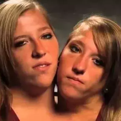 Die siamesischen Zwillinge Abigail und Brittany Hensel konnten ihren größten Wunsch wahr machen