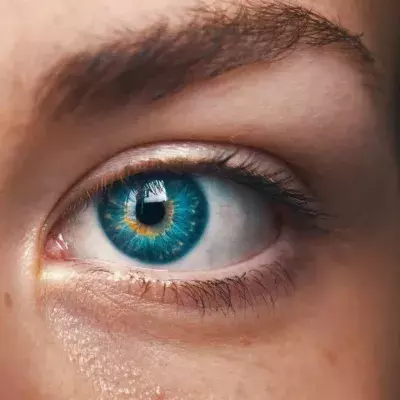 Auge, Iris, Farbe, Krankheit