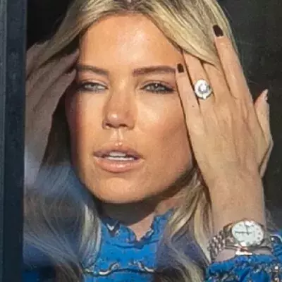 Total-Veränderung bei Sylvie Meis: Was ist mit ihrem Gesicht los?