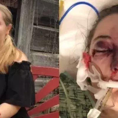 Teenager erkrankt myteriös nach Kreuzschifffahrt