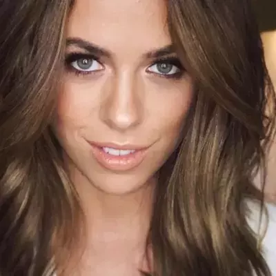 Vanessa Mai ohne Bluse: Doch etwas auf ihrer Haut beunruhigt die Fans