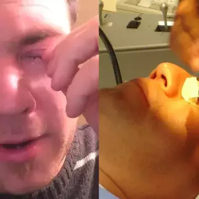 Mann klagt über Juckreiz: Dann findet sein Arzt etwas Unglaubliches in seinem Auge!
