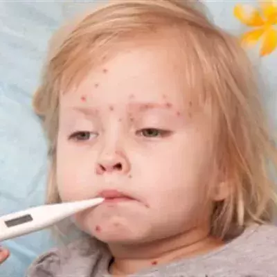 Reye-Syndrom: Symptome, Ursachen, Behandlung