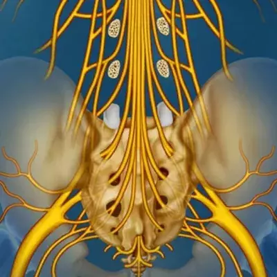 Cauda-equina-Syndrom: Symptome, Folgen, Ursachen, Behandlung
