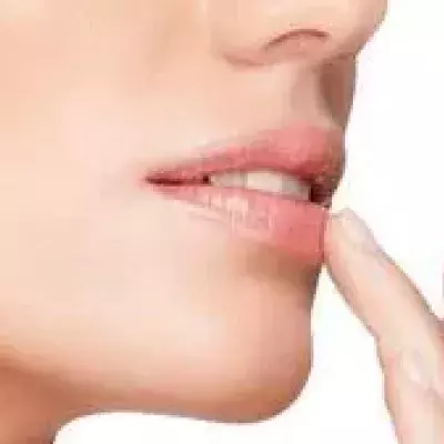 Herpes labialis (Lippenherpes): Ansteckung, Ursachen, Symptome, Dauer, Behandlung und Therapie, wie heilt man es?
