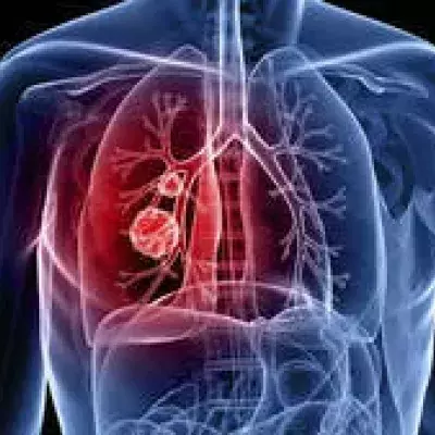 Lungenkrebs: Definition, Ursachen, Diagnose, Symptome und Anzeichen, Therapie und Behandlung, um was handelt es sich?